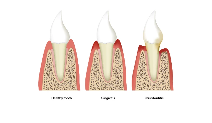 Kamistad mit Kamille