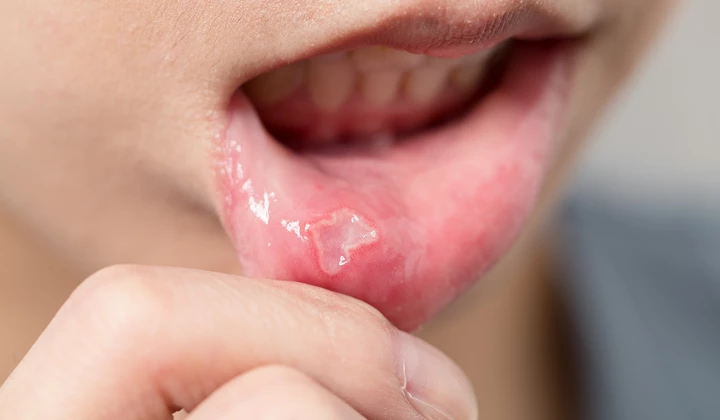 Kamistad mit Kamille